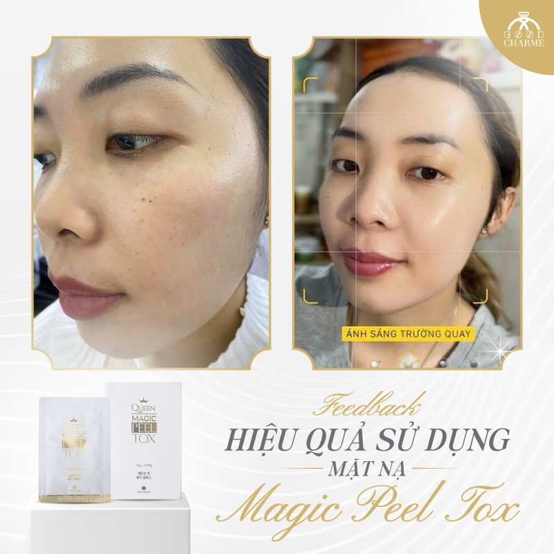 mặt nạ good charme magic peel tox